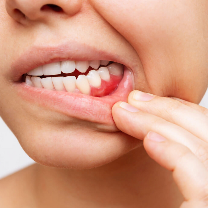 Studio Medico Dentistico Castello parodontologia gengive