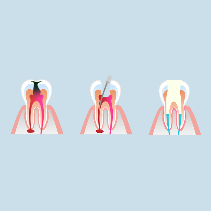 Studio Medico Dentistico Castello endodonzia