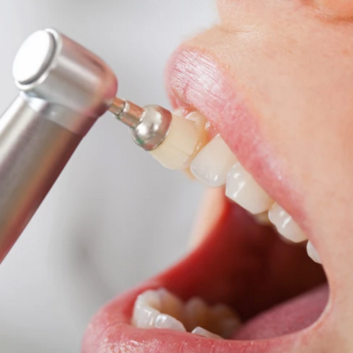 Studio Medico Dentistico Castello igiene orale