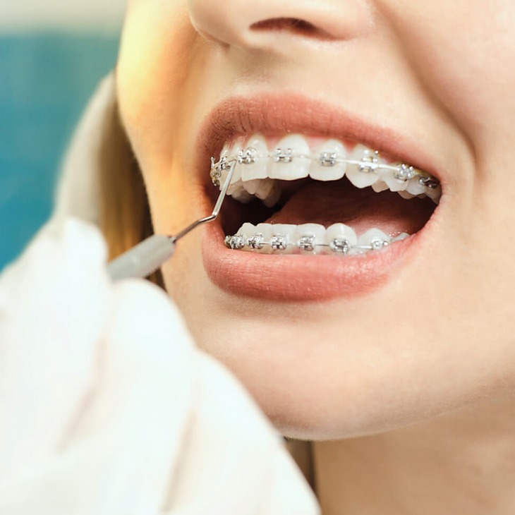 Studio medico dentistico castello ortodonzia classica