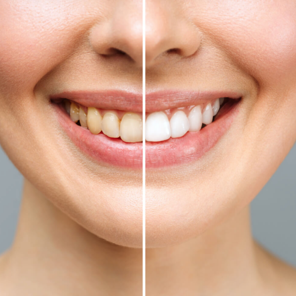 Studio medico dentistico castello estetica dentale sbiancamento
