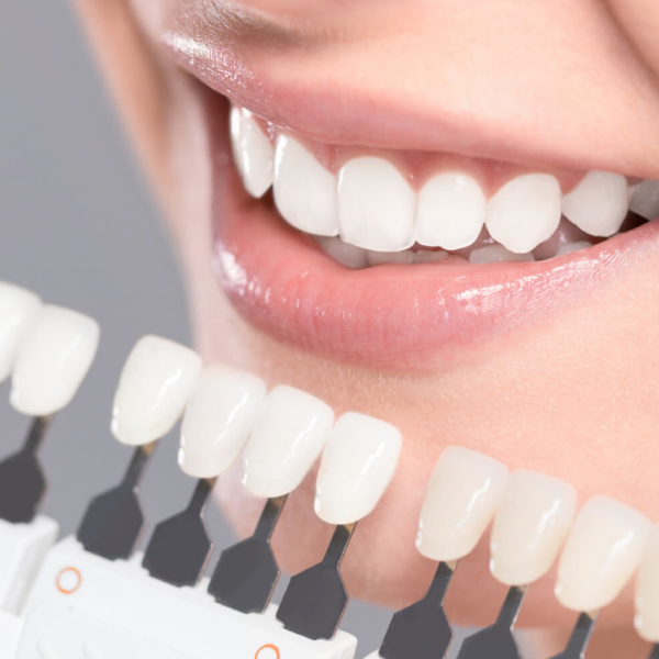 Studio medico dentistico castello estetica dentale faccette