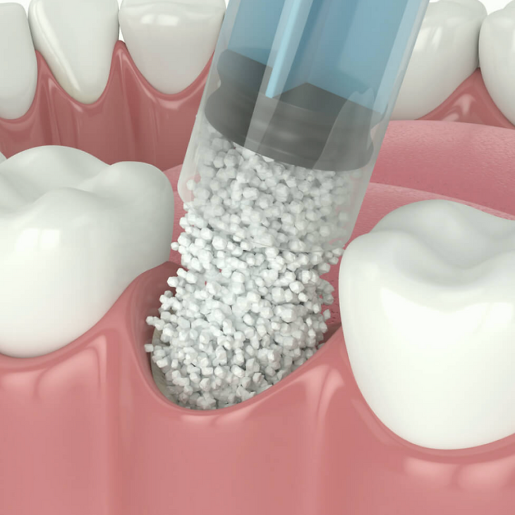 Studio Medico Dentistico Castello chirurgia estrazioni dentali