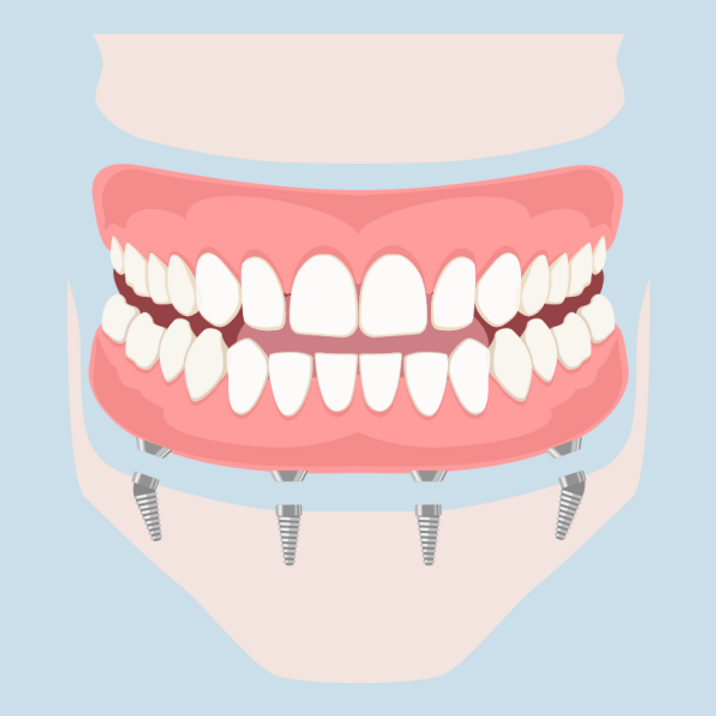 Studio Medico Dentistico Castello protesica dentale