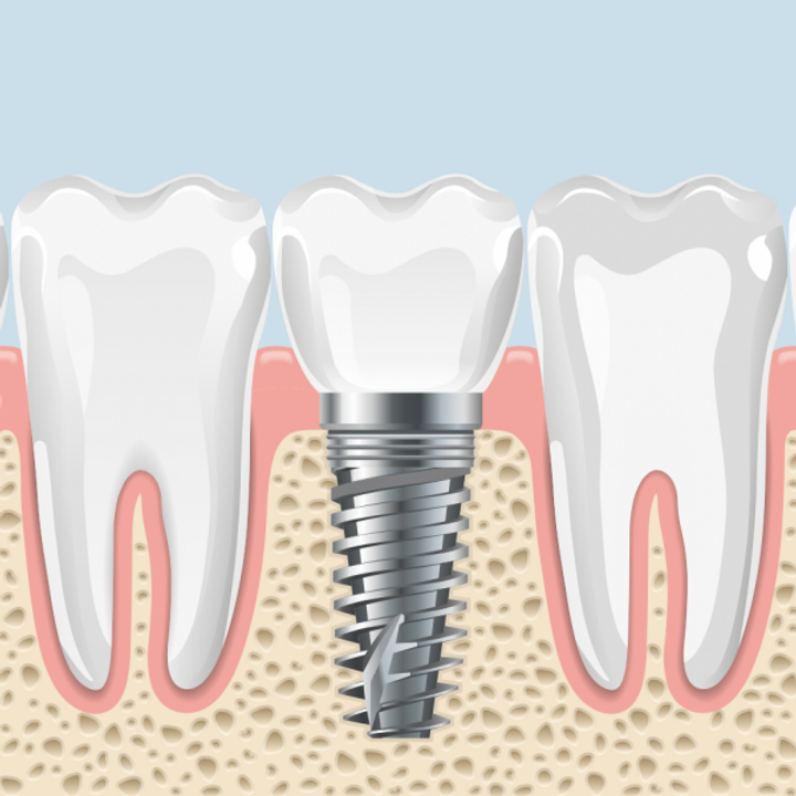 Studio medico dentistico castello implantologia