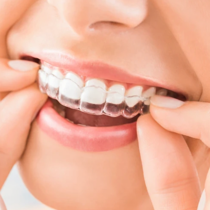 Studio medico dentistico castello ortodonzia invisibile